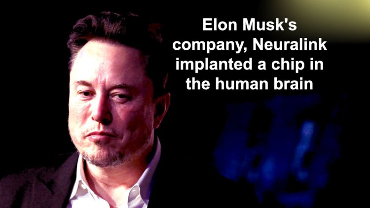 एलन मस्क की कंपनी, न्यूरालिंक ने लगा दी इंसान के दिमाग में चिप