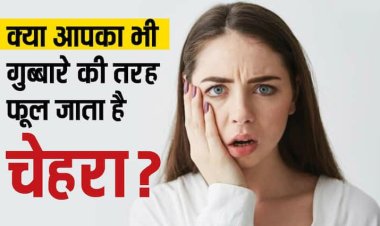 सोकर उठने के बाद कहीं आपका चेहरा भी तो नहीं सूजा रहता, खतरनाक बीमारी का है ये संकेत