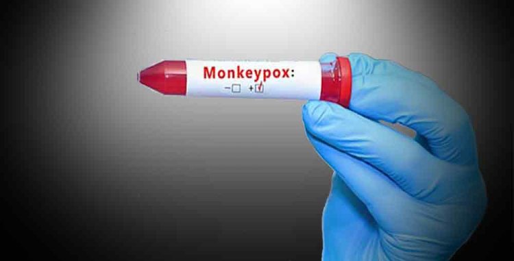 Monkeypox Symptoms: दिल्ली के बाद केरल में भी मिला मंकीपॉक्स का केस, दुबई से लौटा था शख्स