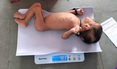 गंभीर कुपोषित प्रशांत पूर्ण रूप से हुआ स्वस्थ