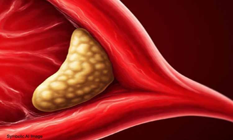 नैचुरल तरीके से कोलेस्ट्रॉल स्तर में नियंत्रण, 50% तक कमी संभव